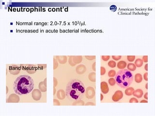 Neutrophils cont’d
 Normal range: 2.0-7.5 x 103/l.
 Increased in acute bacterial infections.
Band Neutrphil
 