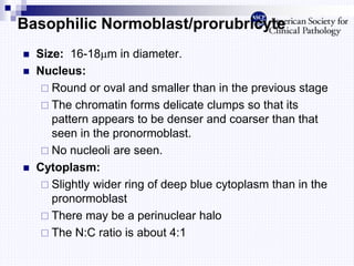 Basophilic Normoblast/prorubricyte
 Size: 16-18m in diameter.
 Nucleus:
 Round or oval and smaller than in the previous stage
 The chromatin forms delicate clumps so that its
pattern appears to be denser and coarser than that
seen in the pronormoblast.
 No nucleoli are seen.
 Cytoplasm:
 Slightly wider ring of deep blue cytoplasm than in the
pronormoblast
 There may be a perinuclear halo
 The N:C ratio is about 4:1
 