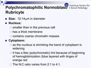Polychromatophilic Normoblast/
Rubricyte
 Size: 12-14m in diameter
 Nucleus:
 smaller than in the previous cell
 has a thick membrane
 contains coarse chromatin masses
 Cytoplasm:
 as the nucleus is shrinking the band of cytoplasm is
widening
 It has a lilac (polychromatic) tint because of beginning
of hemoglobinization (blue layered with tinges of
orange red
 The N:C ratio varies from 2:1 to 4:1.
 