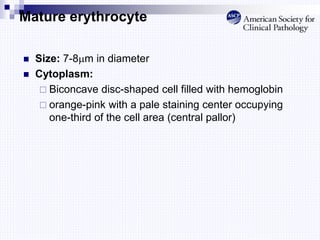 Mature erythrocyte
 Size: 7-8m in diameter
 Cytoplasm:
 Biconcave disc-shaped cell filled with hemoglobin
 orange-pink with a pale staining center occupying
one-third of the cell area (central pallor)
 