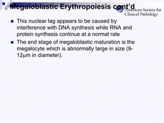 Megaloblastic Erythropoiesis cont’d
 This nuclear lag appears to be caused by
interference with DNA synthesis while RNA and
protein synthesis continue at a normal rate
 The end stage of megaloblastic maturation is the
megalocyte which is abnormally large in size (9-
12m in diameter).
 