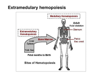 Extramedulary hemopoiesis
 