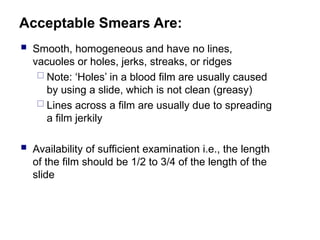 Sufficient Ridges Hema I Chapter 5_pheripheral blood smerae | PPT