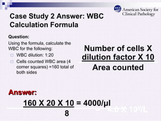 Case Study 2 Answer: WBC
Calculation Formula
Question:
Using the formula, calculate the
WBC for the following:
 WBC dilution: 1:20
 Cells counted WBC area (4
corner squares) =160 total of
both sides
Number of cells X
dilution factor X 10
Area counted
Answer:
160 X 20 X 10 = 4000/μl
8 = 4.0 X 109/L
 