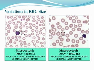 Microcytic Rbc Size Hema II Chapter 1_RBC morphology study.pptx