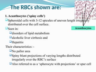 Hema II Chapter 1_RBC morphology study.pptx