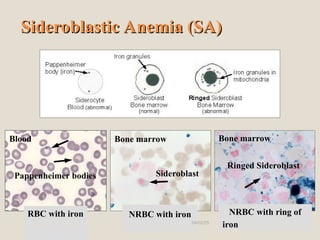Iron Left In Rbc Hema II Chapter 2_Anemia morphology .ppt