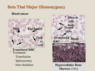 Target Cell Definition Rbc Hema II Chapter 2_Anemia morphology .ppt