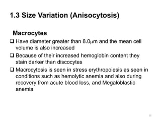 1.3 Size Variation (Anisocytosis)
Macrocytes
 Have diameter greater than 8.0m and the mean cell
volume is also increased
 Because of their increased hemoglobin content they
stain darker than discocytes
 Macrocytosis is seen in stress erythropoiesis as seen in
conditions such as hemolytic anemia and also during
recovery from acute blood loss, and Megaloblastic
anemia
10
 