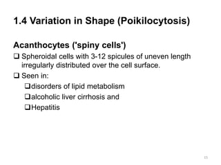 1.4 Variation in Shape (Poikilocytosis)
Acanthocytes ('spiny cells')
 Spheroidal cells with 3-12 spicules of uneven length
irregularly distributed over the cell surface.
 Seen in:
disorders of lipid metabolism
alcoholic liver cirrhosis and
Hepatitis
15
 