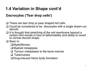 1.4 Variation in Shape cont’d
Dacrocytes ('Tear drop cells')
 These are tear drop or pear shaped red cells
 Could be considered to be discocytes with a single drawn out
spicule.
 It is thought that stretching of the cell membrane beyond a
certain limit results in loss of deformability and ability to revert
to normal discoid shape.
 Seen in:
Myelofibrosis,
Myeloid metaplasia
 Tumour metastases to the bone marrow
 Tuberculosis
Drug-induced Heinz body formation
17
 