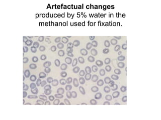 Artefactual changes
produced by 5% water in the
methanol used for fixation.
 