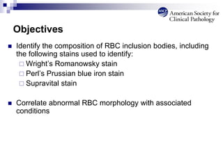 Objectives
 Identify the composition of RBC inclusion bodies, including
the following stains used to identify:
 Wright’s Romanowsky stain
 Perl’s Prussian blue iron stain
 Supravital stain
 Correlate abnormal RBC morphology with associated
conditions
 
