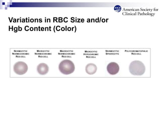Variations in RBC Size and/or
Hgb Content (Color)
 