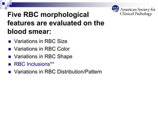  Variations in RBC Size
 Variations in RBC Color
 Variations in RBC Shape
 RBC Inclusions**
 Variations in RBC Distribution/Pattern
Five RBC morphological
features are evaluated on the
blood smear:
 
