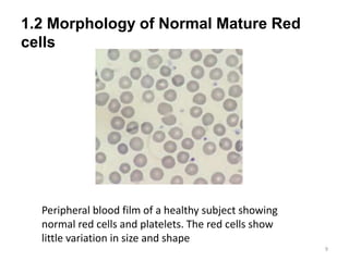 1.2 Morphology of Normal Mature Red
cells
9
Peripheral blood film of a healthy subject showing
normal red cells and platelets. The red cells show
little variation in size and shape
 