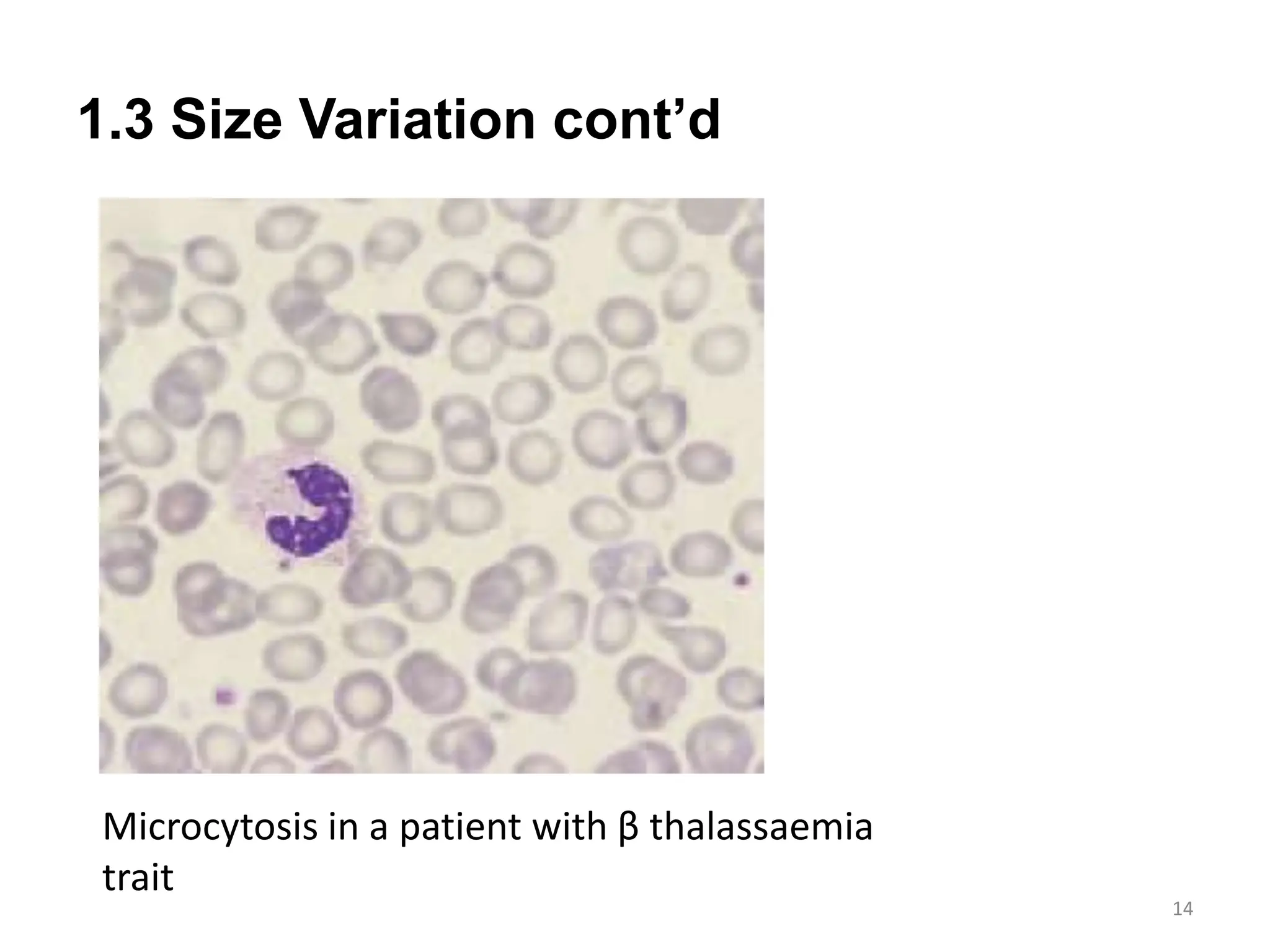 Hema II Chapter 2_RBC morphology study_AT.ppt