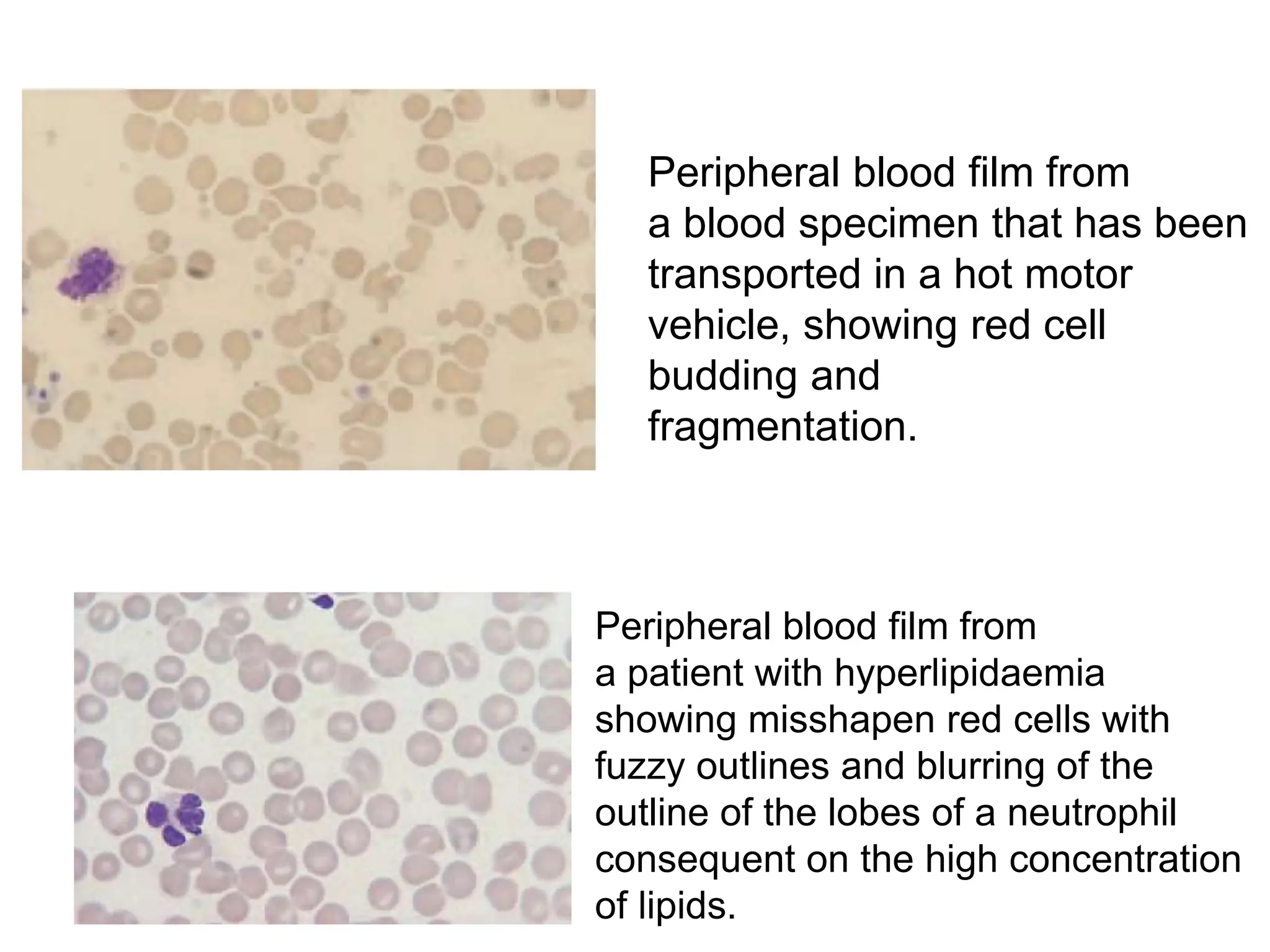 Hema II Chapter 2_RBC morphology study_AT.ppt