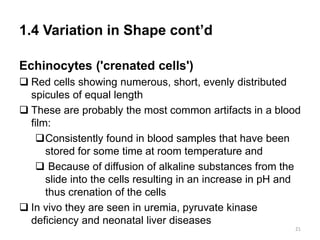1.4 Variation in Shape cont’d
Echinocytes ('crenated cells')
 Red cells showing numerous, short, evenly distributed
spicules of equal length
 These are probably the most common artifacts in a blood
film:
Consistently found in blood samples that have been
stored for some time at room temperature and
 Because of diffusion of alkaline substances from the
slide into the cells resulting in an increase in pH and
thus crenation of the cells
 In vivo they are seen in uremia, pyruvate kinase
deficiency and neonatal liver diseases
21
 