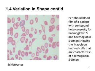 1.4 Variation in Shape cont’d
27
Schistocytes
Peripheral blood
film of a patient
with compound
heterozygosity for
haemoglobin S
and haemoglobin
S-Oman showing
the ‘Napoleon
hat’ red cells that
are characteristic
of haemoglobin
S-Oman
 