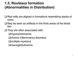 1.5. Rouleaux formation
(Abnormalities in Distribution)
 Red cells are aligned in formations resembling stacks of
coins
 May be seen as artifacts in the thick areas of the blood
film
 They are often associated with:
Hyperproteinemia
chronic inflammatory disorders
multiple myeloma
macroglobulinemia
37
 