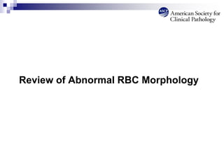 Review of Abnormal RBC Morphology
 