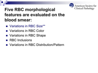 Five RBC morphological
features are evaluated on the
blood smear:
 Variations in RBC Size**
 Variations in RBC Color
 Variations in RBC Shape
 RBC Inclusions
 Variations in RBC Distribution/Pattern
 