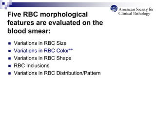 Five RBC morphological
features are evaluated on the
blood smear:
 Variations in RBC Size
 Variations in RBC Color**
 Variations in RBC Shape
 RBC Inclusions
 Variations in RBC Distribution/Pattern
 