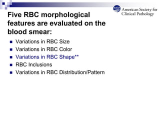  Variations in RBC Size
 Variations in RBC Color
 Variations in RBC Shape**
 RBC Inclusions
 Variations in RBC Distribution/Pattern
Five RBC morphological
features are evaluated on the
blood smear:
 