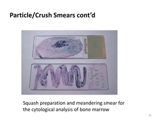 Hema II Chapter 7_BM examination.ppt