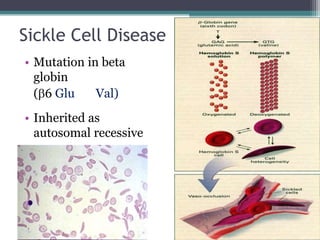 Sickle Cell Disease
• Mutation in beta
globin
(6 Glu Val)
• Inherited as
autosomal recessive
• Protection against
malaria
 