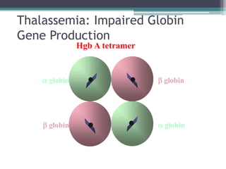 Thalassemia: Impaired Globin
Gene Production
 globin  globin
 globin  globin
Hgb A tetramer
 