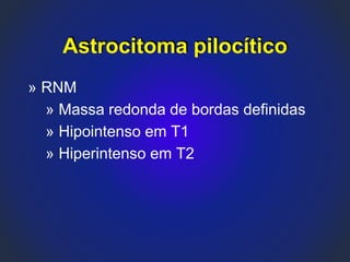 » RNM
» Massa redonda de bordas definidas
» Hipointenso em T1
» Hiperintenso em T2
Astrocitoma pilocítico
 
