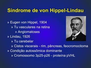 Síndrome de von Hippel-Lindau
» Eugen von Hippel, 1904
» Tu vasculares na retina
» Angiomatoses
» Lindau, 1926
» Tu cerebelar
» Cistos viscerais - rim, pâncreas, feocromocitoma
» Condição autossômica dominante
» Cromossomo 3p25-p26 - proteína pVHL
 