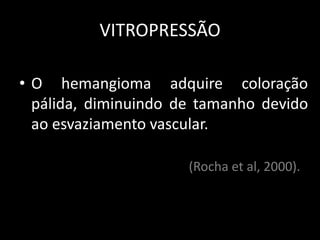 VITROPRESSÃO

• O hemangioma adquire coloração
  pálida, diminuindo de tamanho devido
  ao esvaziamento vascular.

                      (Rocha et al, 2000).
 