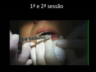 1ª e 2ª sessão
 