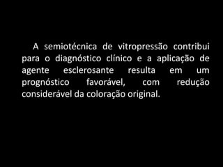 A semiotécnica de vitropressão contribui
para o diagnóstico clínico e a aplicação de
agente esclerosante resulta em um
prognóstico     favorável,    com   redução
considerável da coloração original.
 
