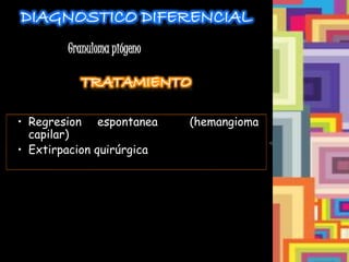 DIAGNOSTICO DIFERENCIAL
TRATAMIENTO
• Regresion espontanea (hemangioma
capilar)
• Extirpacion quirúrgica
Granuloma piógeno
 