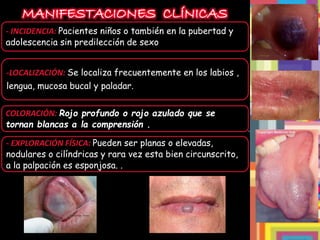 MANIFESTACIONES CLÍNICAS
- INCIDENCIA: Pacientes niños o también en la pubertad y
adolescencia sin predilección de sexo
-LOCALIZACIÓN: Se localiza frecuentemente en los labios ,
lengua, mucosa bucal y paladar.
COLORACIÓN: Rojo profundo o rojo azulado que se
tornan blancas a la comprensión .
- EXPLORACIÓN FÍSICA: Pueden ser planas o elevadas,
nodulares o cilíndricas y rara vez esta bien circunscrito,
a la palpación es esponjosa. .
 