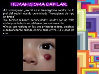 HEMANGIOMA CAPILAR
•El hemangioma juvenil es el hemangioma capilar de la
piel del recién nacido denominado “hemagioma de tipo
en fresa”
•Se forman lesiones pedunculadas, unidas por un tallo
ancho y en la base se adelgaza progresivamente.
•Crece con rapidez en los dos primeros meses, empieza
a desvanecerse cuando el niño tene entre 1 a 3 años de
edad.
 