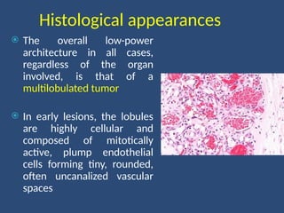 Histological appearances
 The overall low-power
architecture in all cases,
regardless of the organ
involved, is that of a
multilobulated tumor
 In early lesions, the lobules
are highly cellular and
composed of mitotically
active, plump endothelial
cells forming tiny, rounded,
often uncanalized vascular
spaces
 