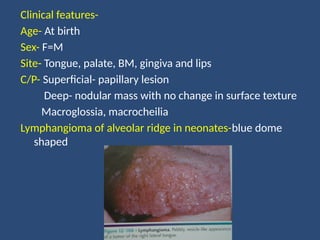 Clinical features-
Age- At birth
Sex- F=M
Site- Tongue, palate, BM, gingiva and lips
C/P- Superficial- papillary lesion
Deep- nodular mass with no change in surface texture
Macroglossia, macrocheilia
Lymphangioma of alveolar ridge in neonates-blue dome
shaped
 