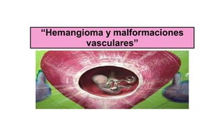 “Hemangioma y malformaciones
vasculares”
 