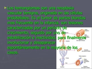 Los hemangiomas son una neoplasia vascular benigna, originada en las células endoteliales: Es el tumor de partes blandas mas frecuente en la infancia. son lesiones  caracterizadas por un período de crecimiento, seguido por uno de estabilización e inactividad, para finalmente involucionar y desaparecer espontáneamente en la mayoría de los casos.  