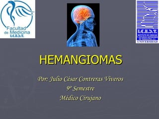 HEMANGIOMAS Por: Julio César Contreras Viveros 9º Semestre Médico Cirujano 