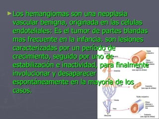 <ul><li>Los hemangiomas son una neoplasia vascular benigna, originada en las células endoteliales: Es el tumor de partes b...