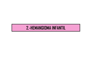 2.-HEMANGIOMA INFANTIL
 