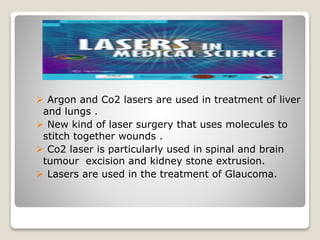  Argon and Co2 lasers are used in treatment of liver
and lungs .
 New kind of laser surgery that uses molecules to
stitch together wounds .
 Co2 laser is particularly used in spinal and brain
tumour excision and kidney stone extrusion.
 Lasers are used in the treatment of Glaucoma.
 
