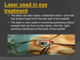 Laser used in eye
treatment
 The laser can also repair a detached retina—one that
has broken loose from the rear part of the eyeball
 The laser is very useful in removing extraneous blood
vessels that can form on the retina—the thin, light-
sensitive membrane at the back of the eyeball
 