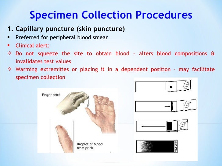 Capillary Puncture